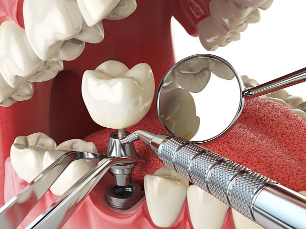 Best Emergency Root Canal Therapy in Flat Rock, MI